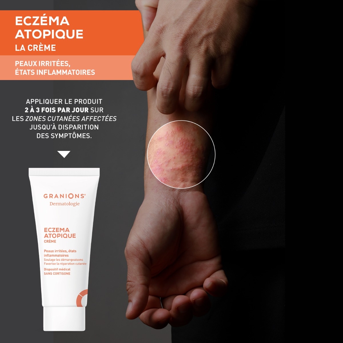 Crème dermatologie eczéma atopique - 30 ml